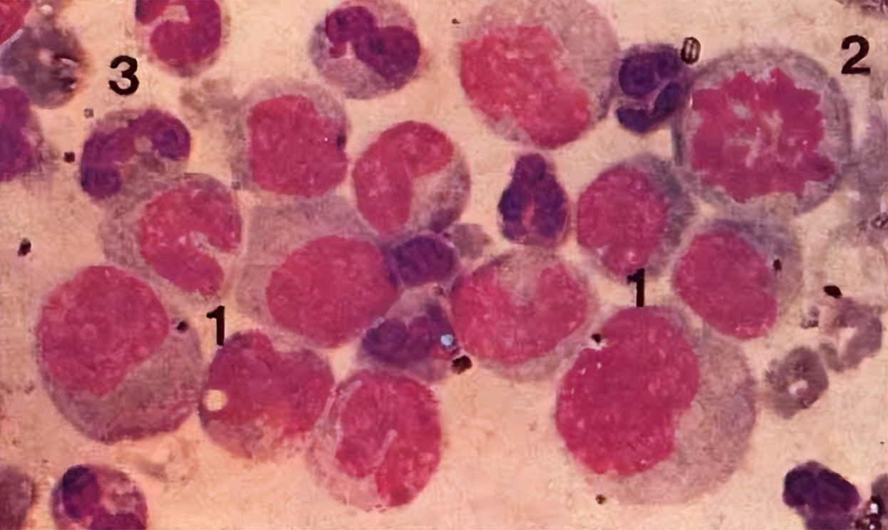 夫妻借了20万做试管婴儿,黑龙江夫妇借22万做试管