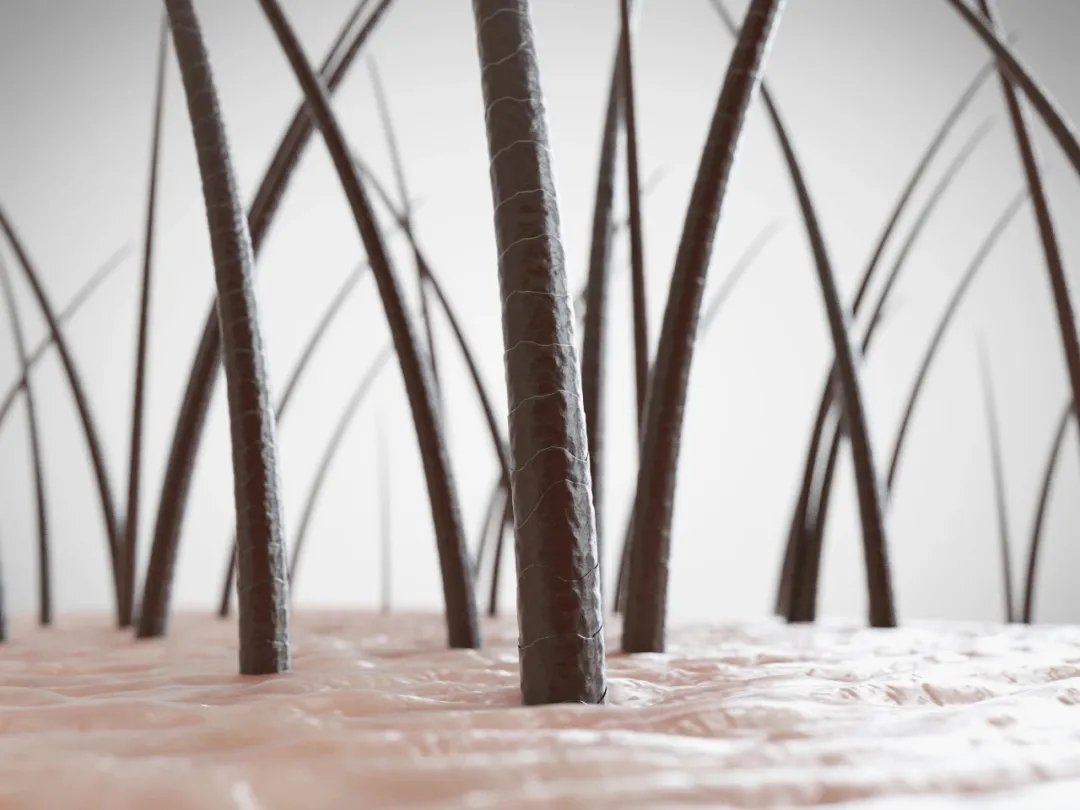 别人脱单你脱发,年轻人脱单脱发