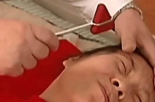 女孩被哥哥打两巴掌装瘫痪20年,女子被嫂子打两巴掌装病卧床20年