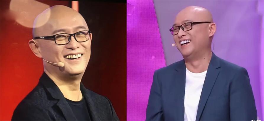 烤瓷牙的明星,烤瓷牙的明星都有谁