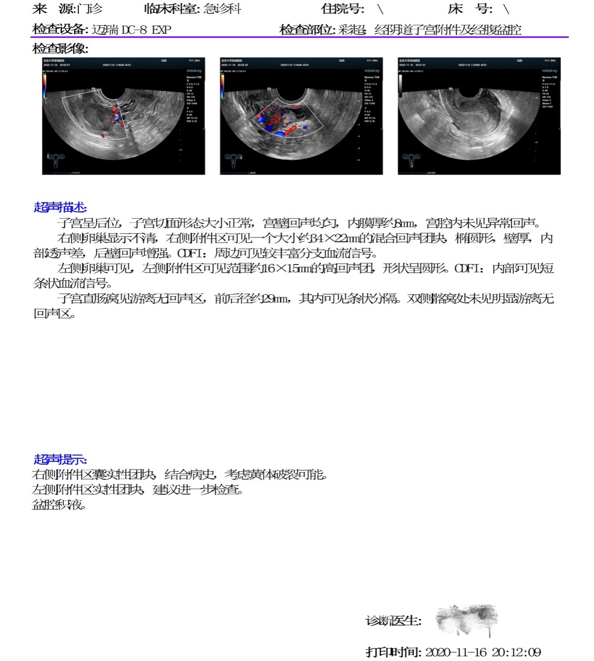 蛋黄摔碎了,蛋黄破了