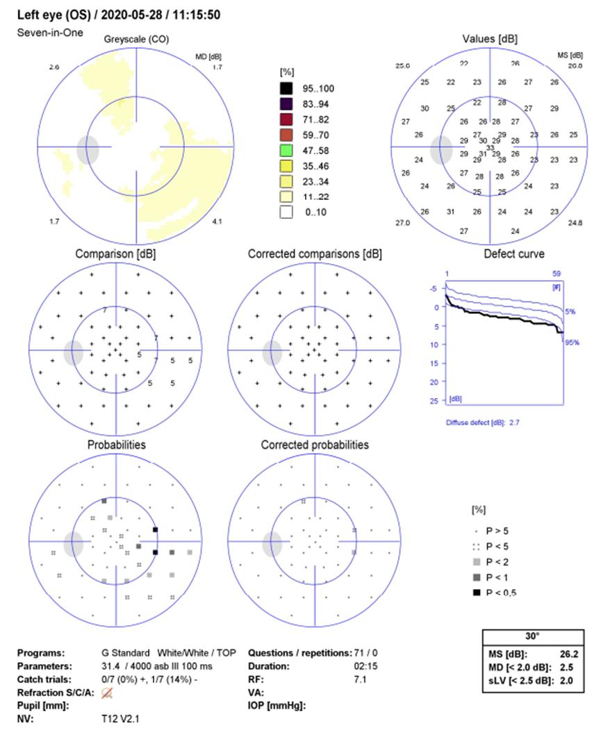 眼视光技术只是学配眼镜吗,眼视光学配眼镜