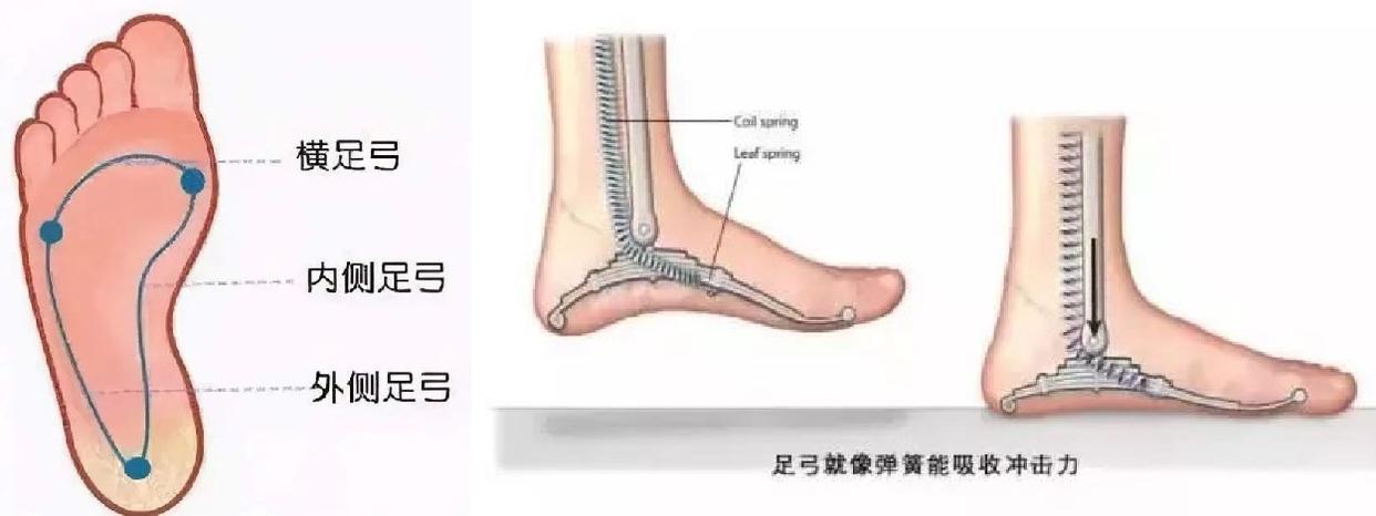 足弓平是什么意思,扁平足弓为什么容易受伤