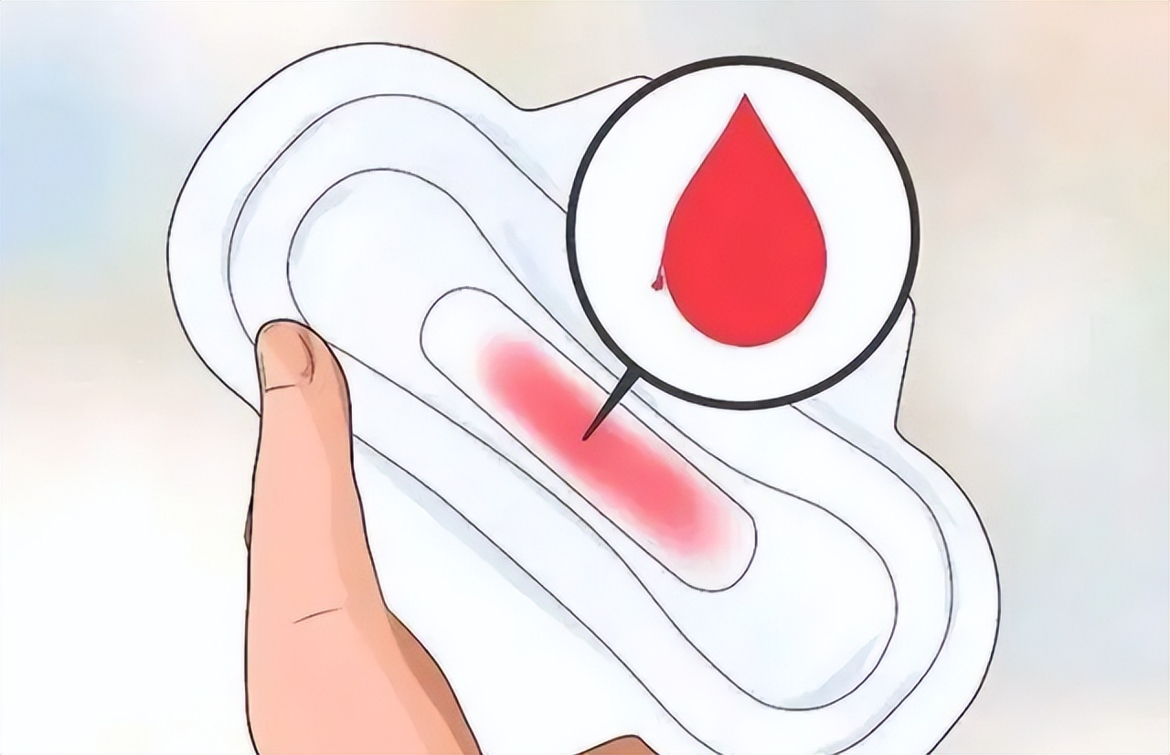 月经结束后有褐色分泌物有问题吗,月经完了后又开始出现褐色分泌物