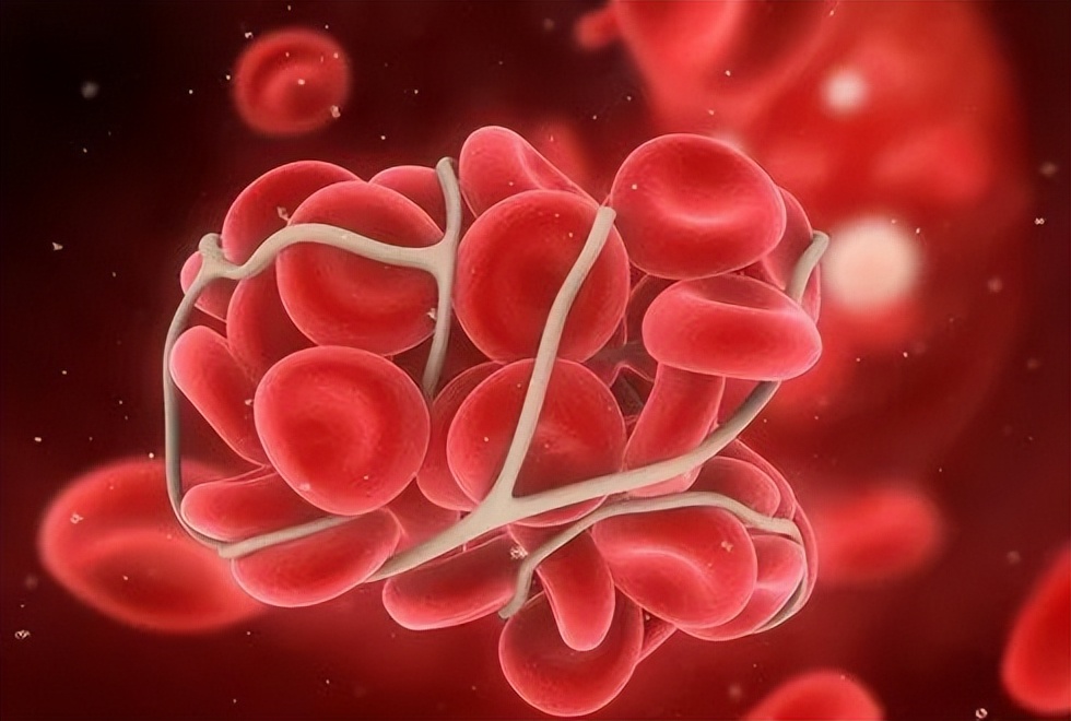 富血小板血浆因子作用,富血小板血浆治疗的目的和意义