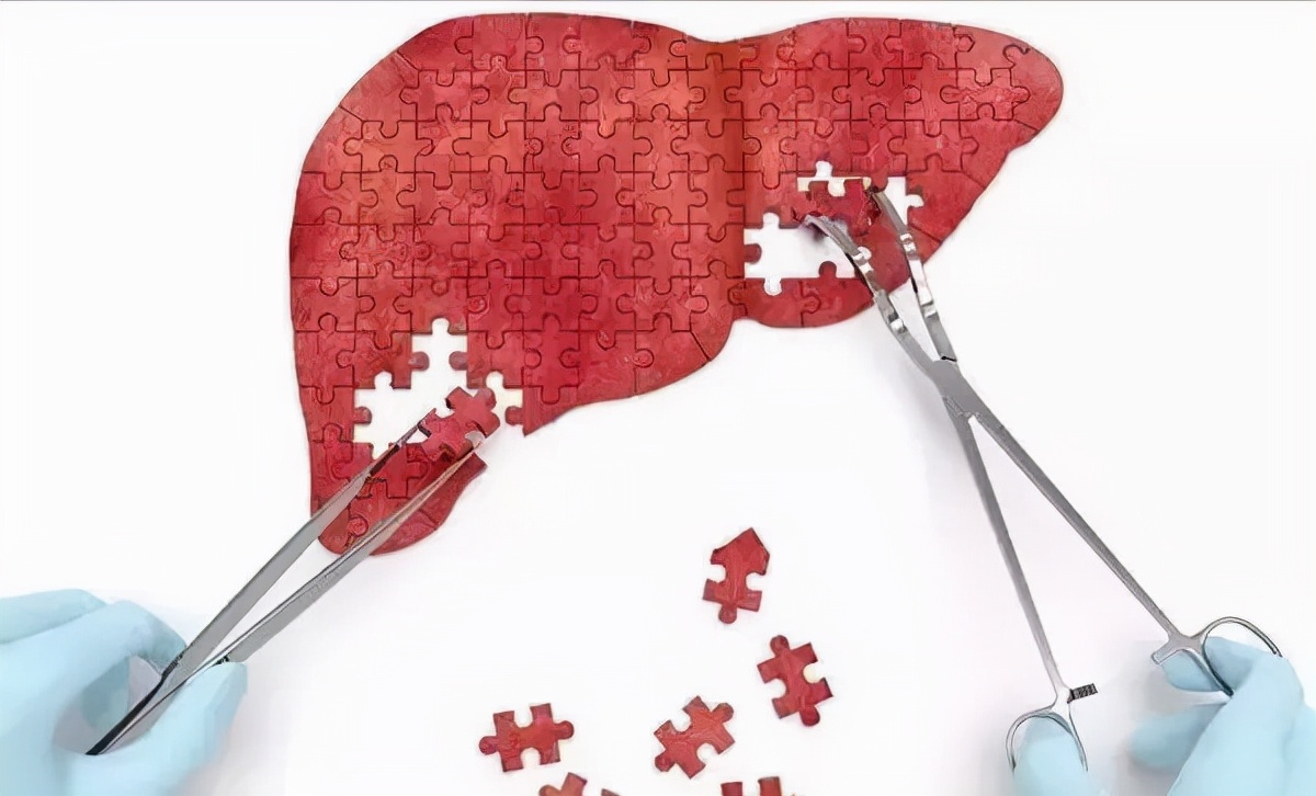 恩替卡韦分散片可以治急性乙肝吗,乙肝恩替卡韦胶囊几年耐药