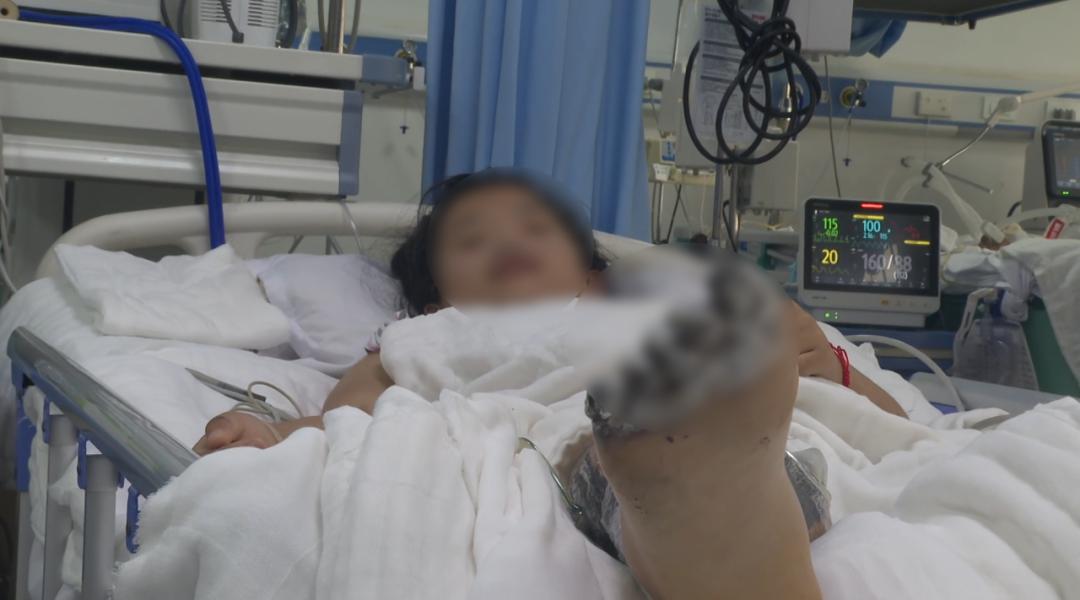 女孩充电时玩手机遭电击面临截肢,女孩手机充电被电击面临截肢