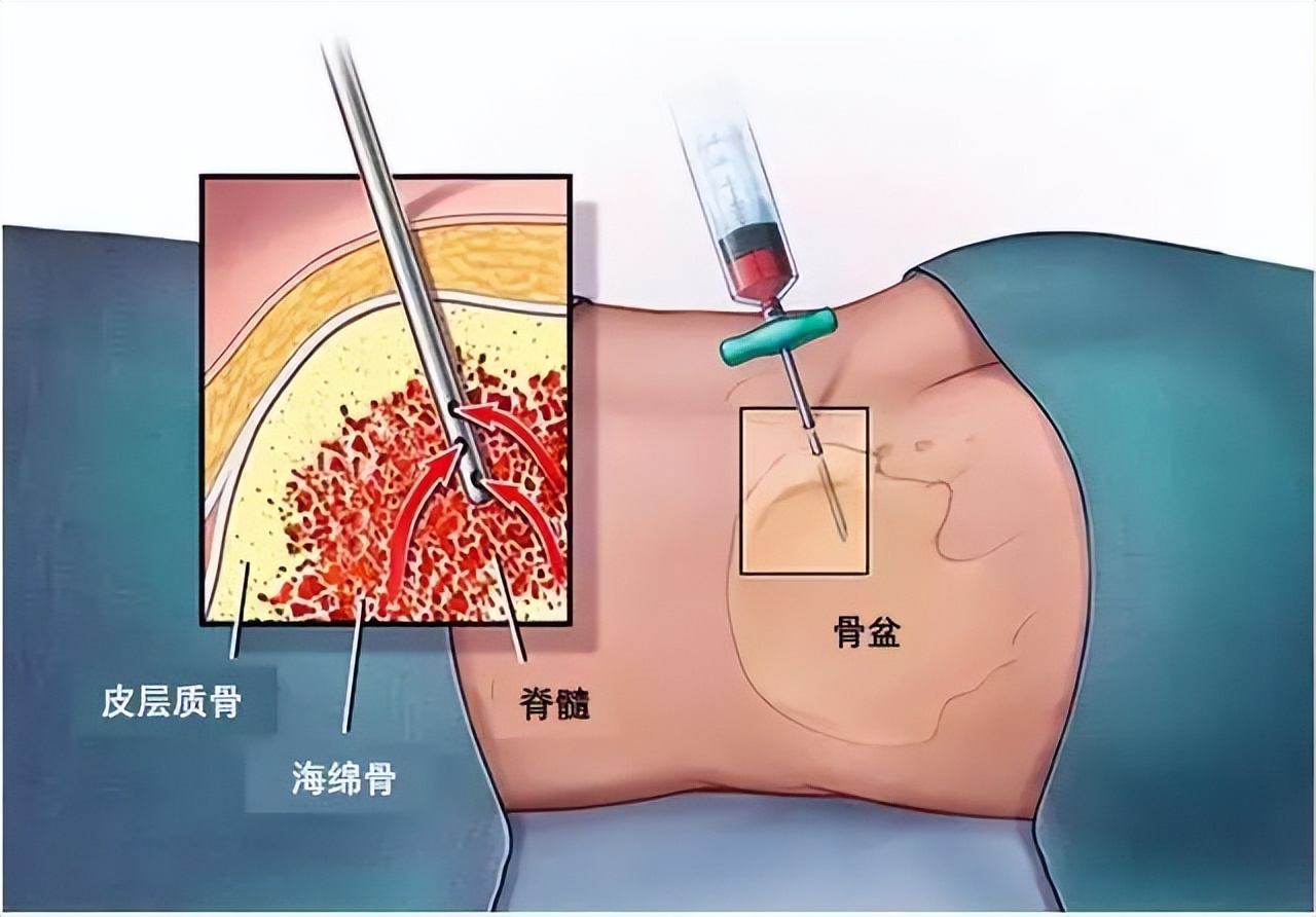 担心自己得癌,体检做什么项目可以查癌
