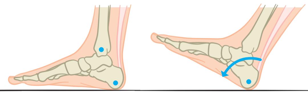 锻炼脚底跟腱的方法有哪些,足部跟腱拉伸的好处