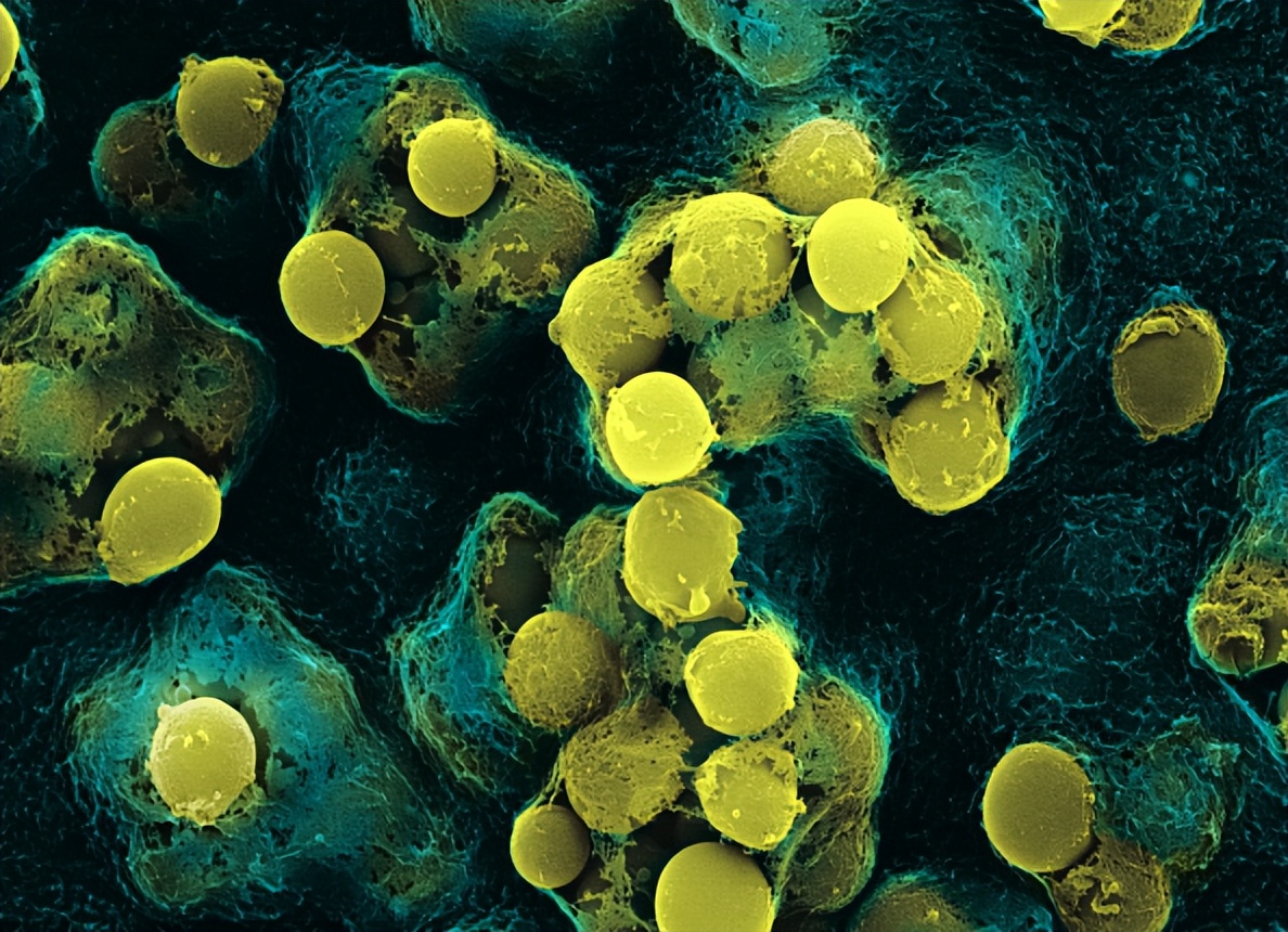 人体抵御细菌感染的第一道防线,人体卫士大战细菌