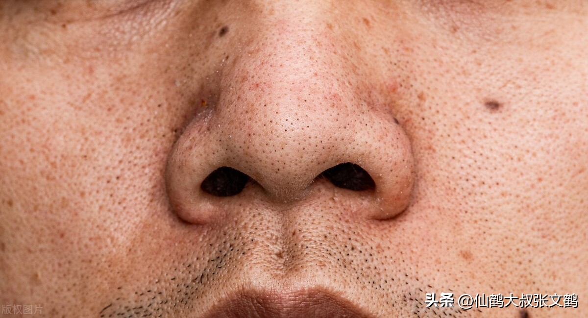 痘印修复鹤叔,鹤叔痘印怎么祛