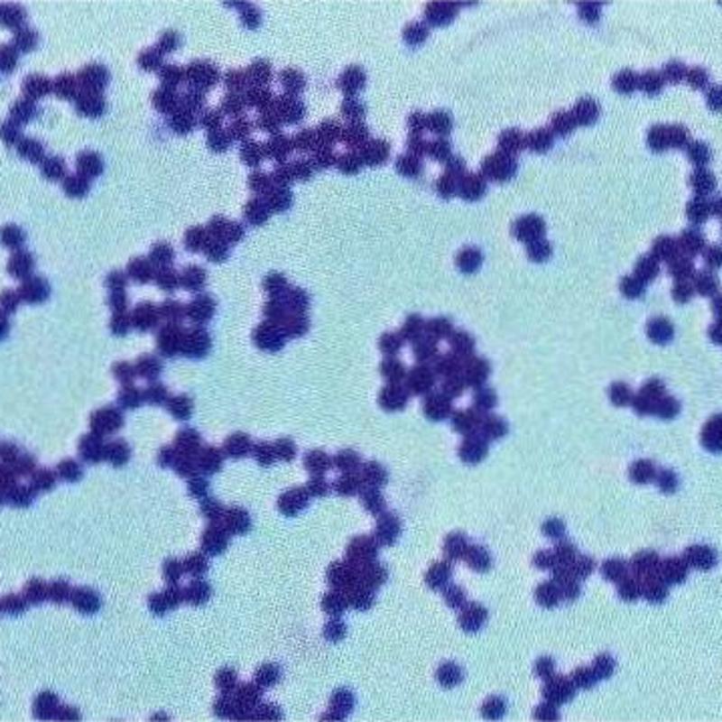 怎么避免金黄色葡萄球菌感染,金黄色葡萄球菌感染会致命吗