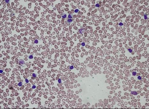 再生医学日本,日本再生医学治疗肾最新进展