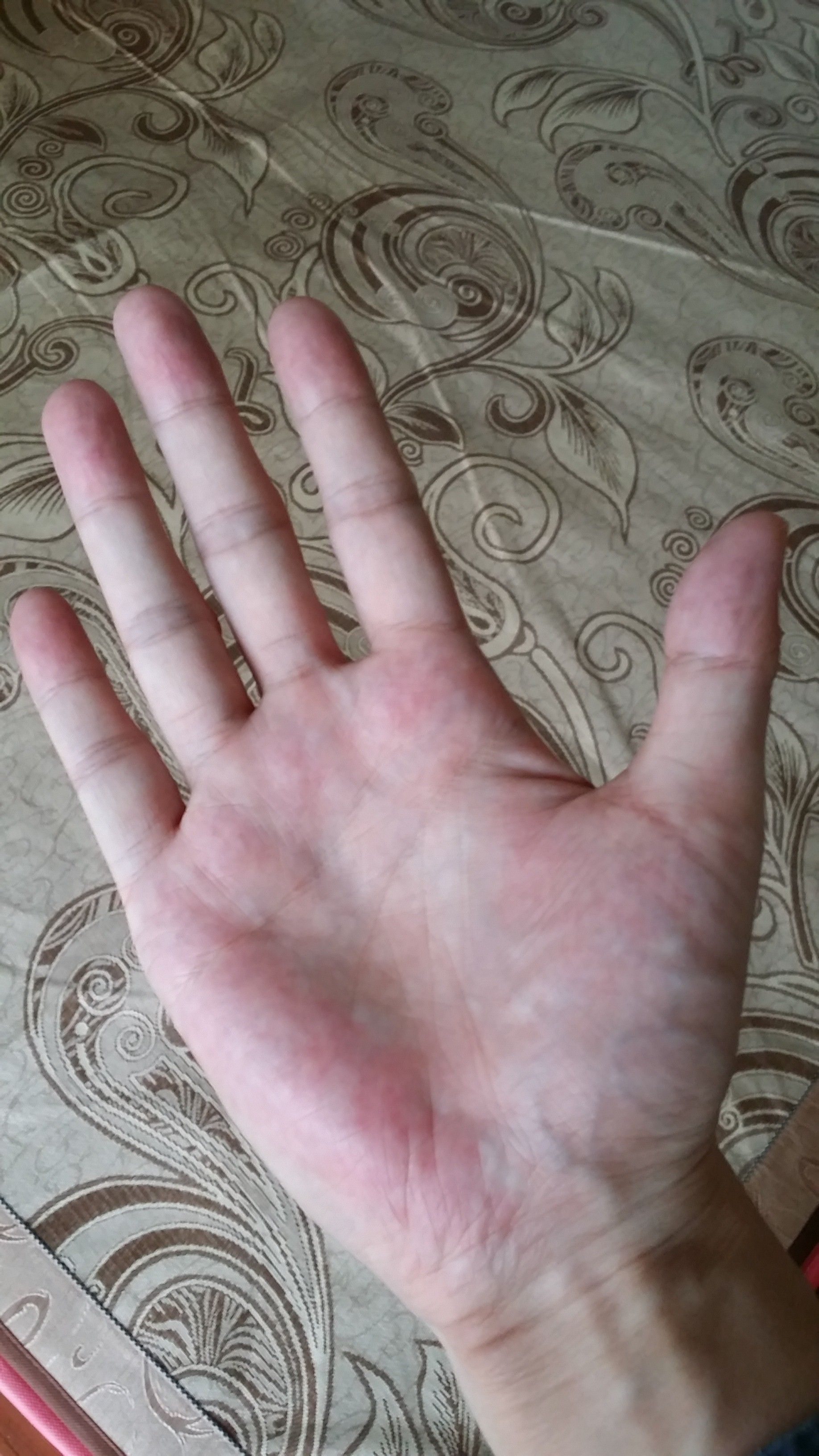 体内有癌手指有哪些征兆,手指出现这一特征体内可能有癌症