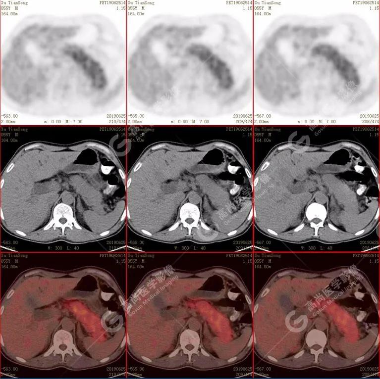 皮肤巩膜黄染无腹痛,腹部皮肤出现黄染
