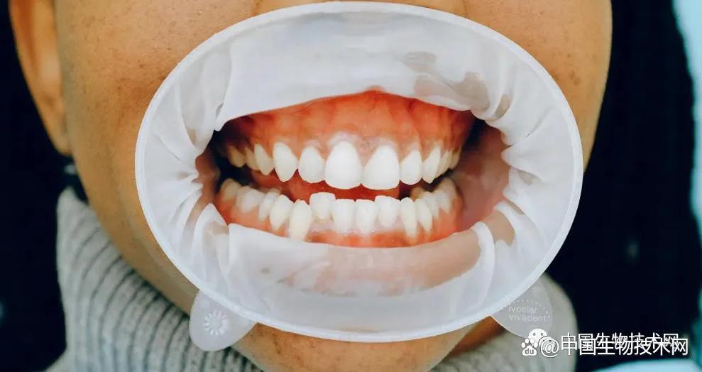 治疗口腔溃疡凝胶医院研制,治疗牙周病的常用的含漱剂