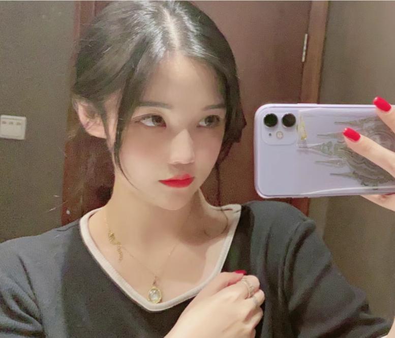 玻尿酸线雕隆鼻照片,做过线雕鼻的鼻子