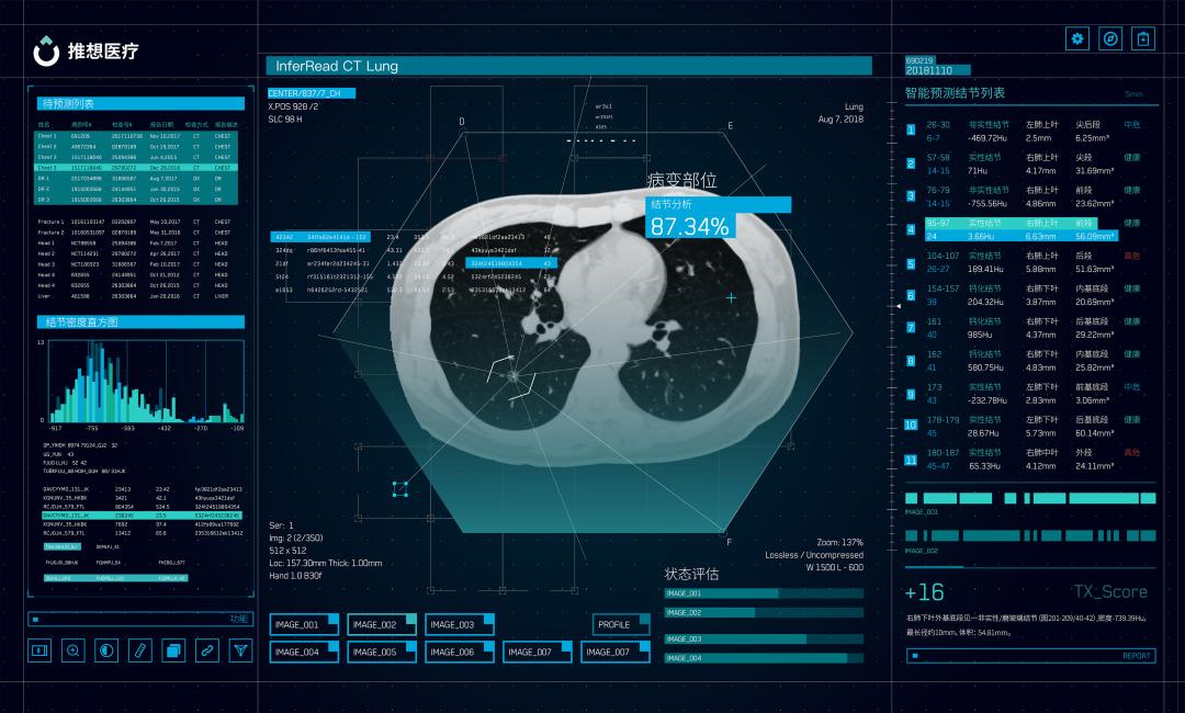 美国最新治疗肺癌特效药,治疗癌症需要的工具