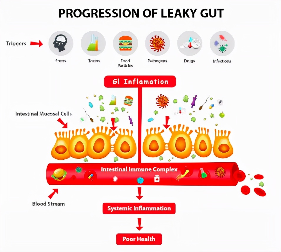 肠道不好有点漏便怎么回事,肠漏会引起什么病