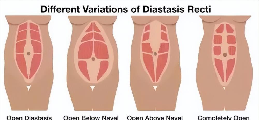 何洁减肥成功90天减重30斤,何洁产后减肥成功案例
