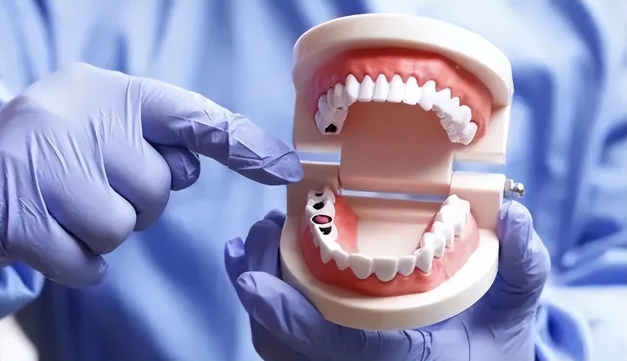 公立医院种牙集采吗,民营医院如何应对种植牙集采