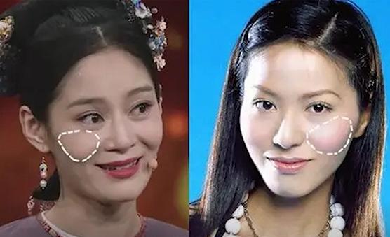 显老的罪魁祸首是什么,显老除了法令纹还有什么纹