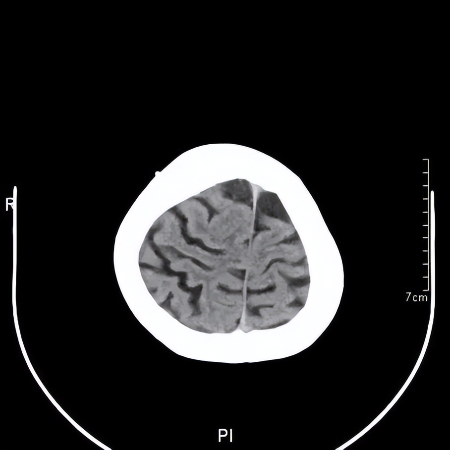 记忆门诊深圳,记忆门诊诊疗流程
