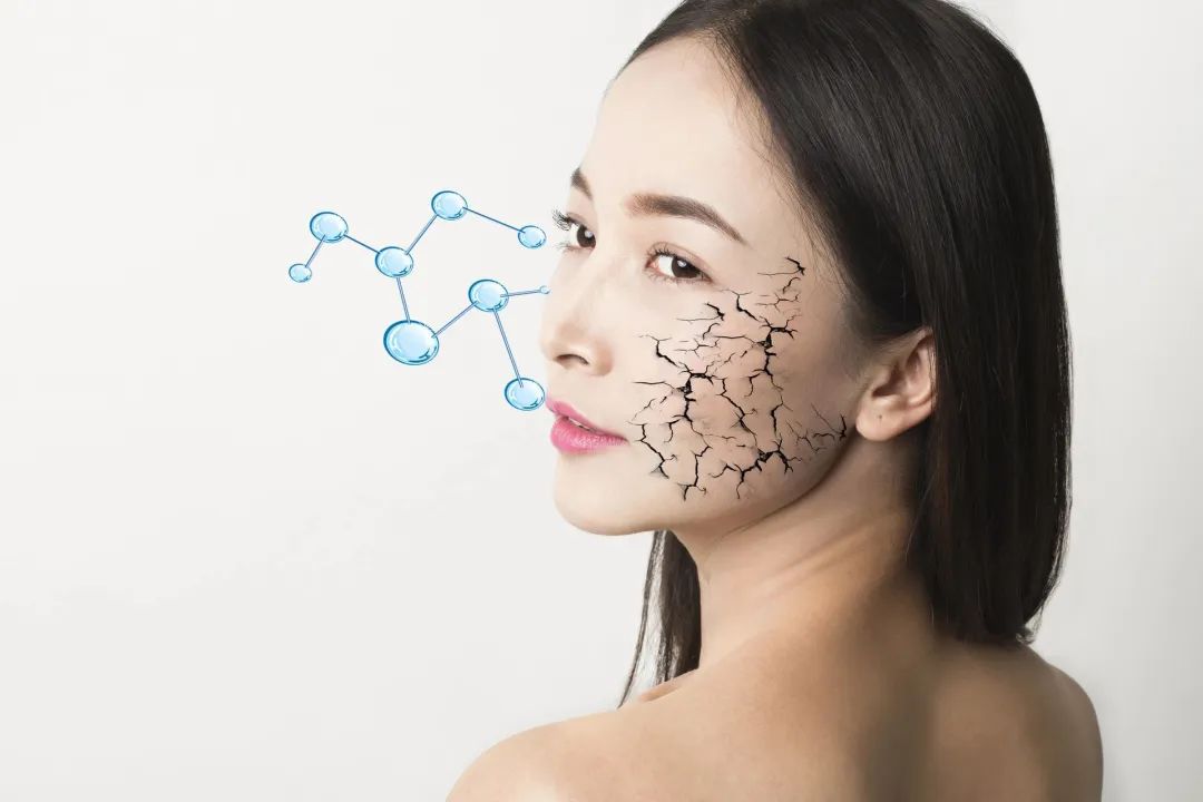 水油失衡怎么改善,水油失衡调节