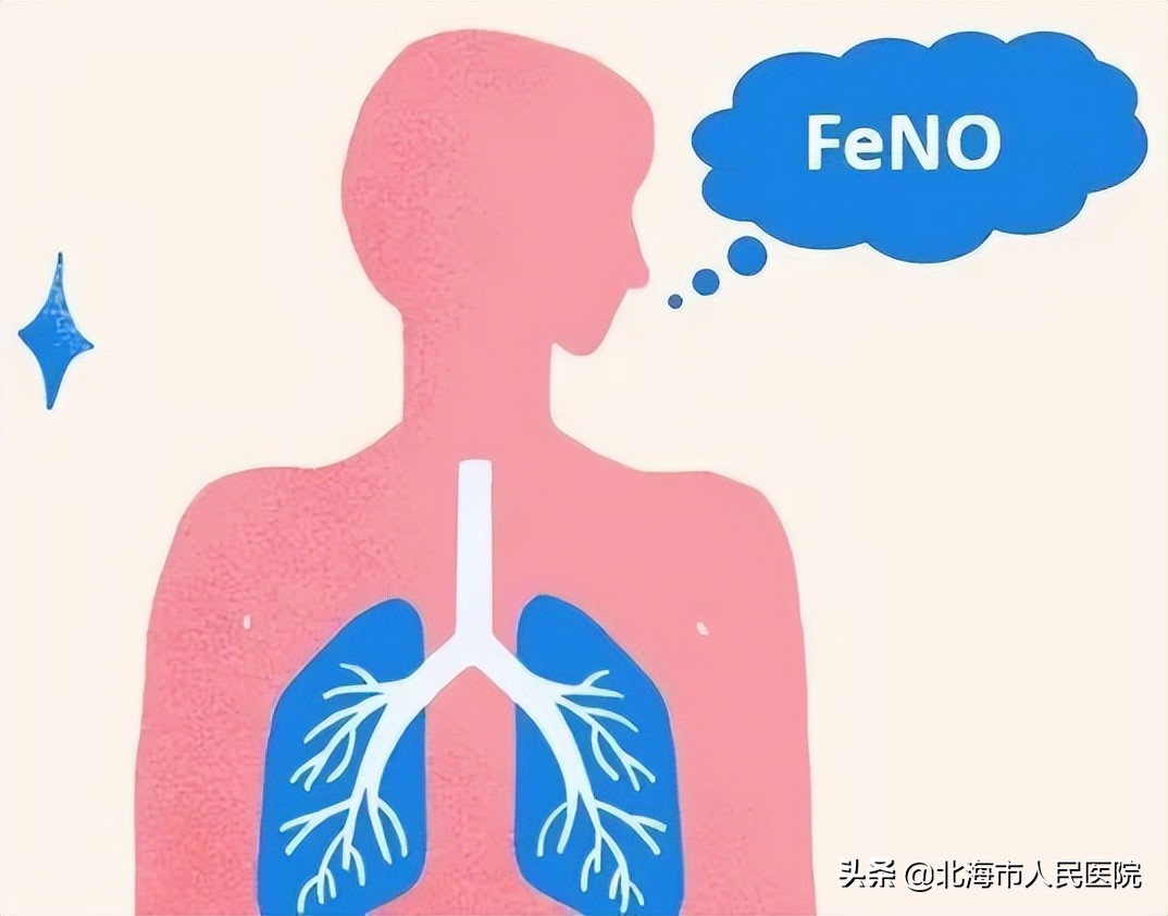 呼出一氧化碳测定是检查什么的,呼出气氧化氮测定是查什么病的