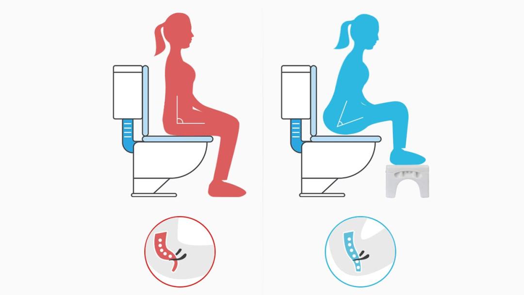 先别冲！原来你是这样的——“便便”