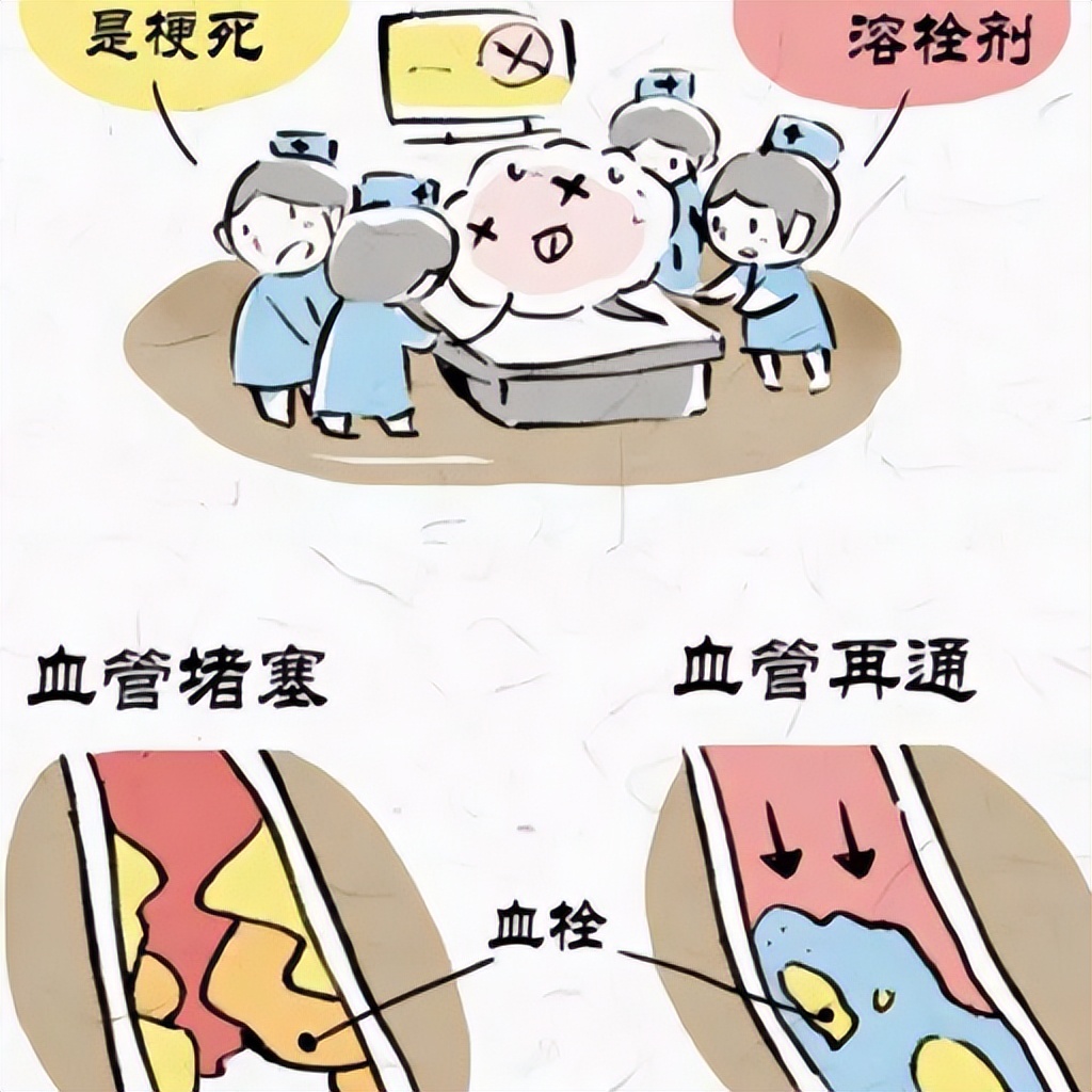 与时间赛跑抢救患者,脑梗死静脉溶栓治疗最新指南ppt