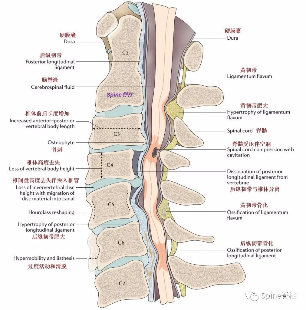 脊柱的神经支配,脊柱神经引起手臂疼痛