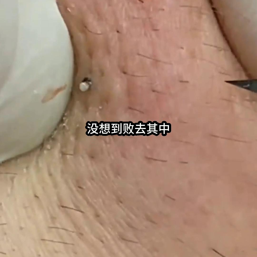 那渣男12年后居然回来找我妈复合???还带了个爱炫富的...