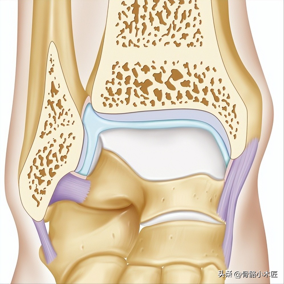 踝部骨折属于几级伤残,踝部骨折多久可以下地