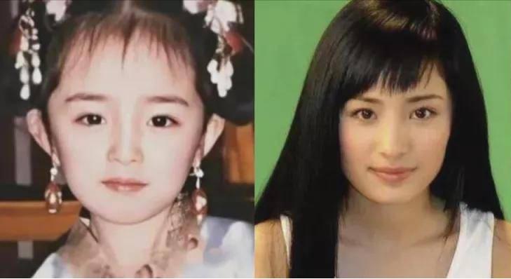 发腮和塌腮哪个更显老,发腮真的显老吗