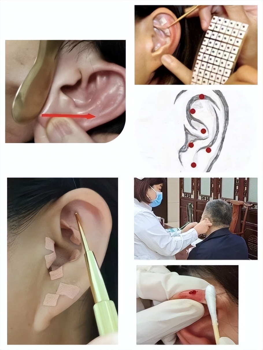 女性关爱女性健康医学科普,关爱女性健康绽放巾帼魅力