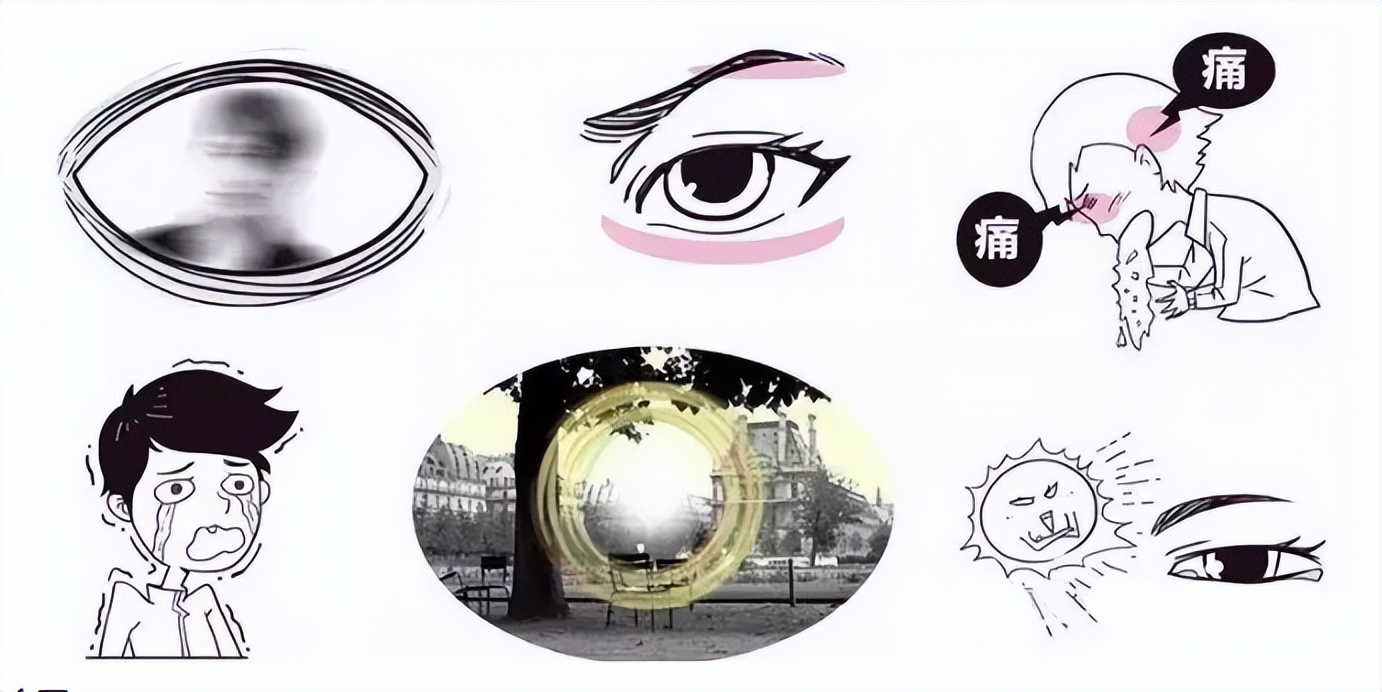 “瞳神紧小”——虹膜睫状体炎