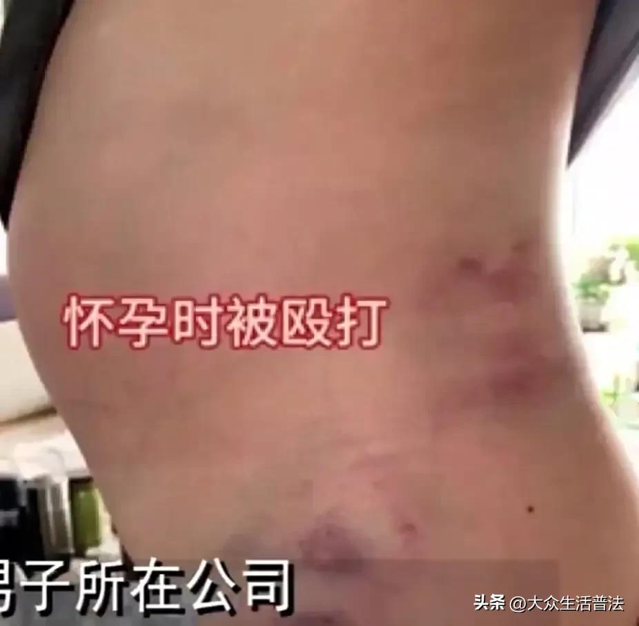 怀孕被打怎么赔偿,孕初期被打后续怎么处罚