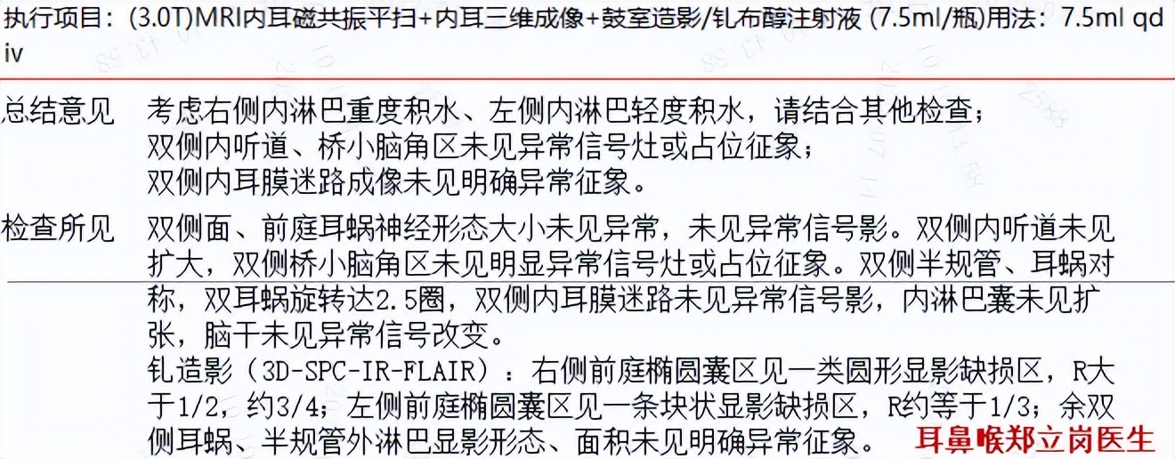 顽固眩晕，手术可治愈