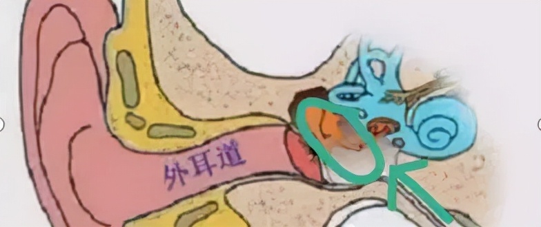 儿童中耳炎是怎么导致的耳朵疼,小孩中耳炎如何缓解耳朵疼痛