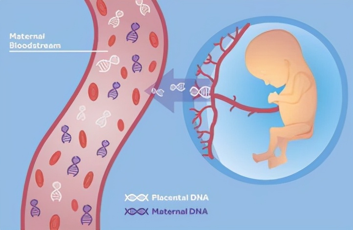 孕妇nt值超标什么导致的,nt染色体异常风险
