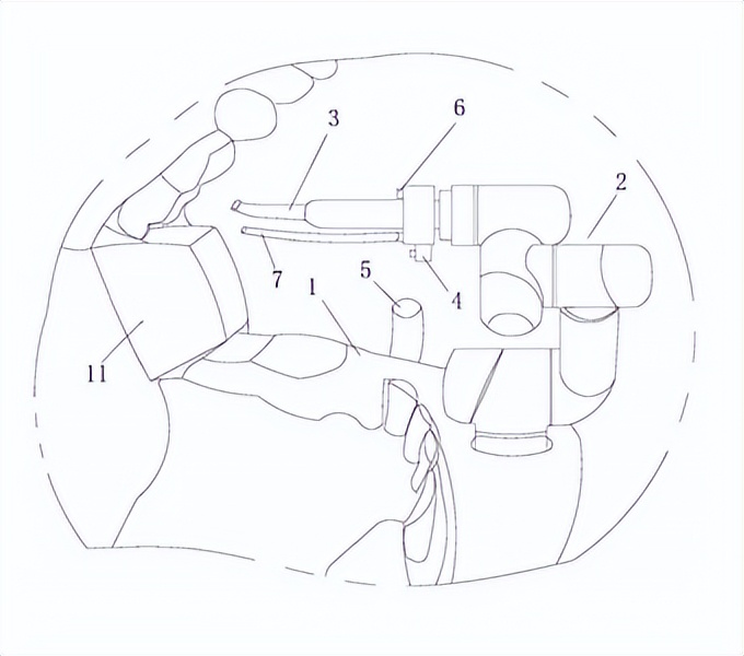 牙科最新器械,口腔医疗器械的现状及前景