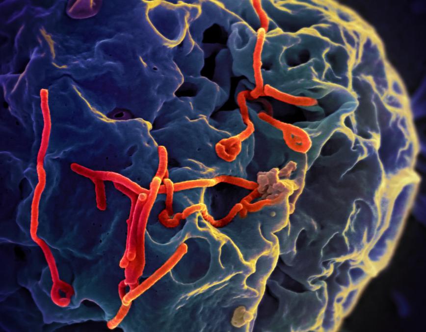 安全套的油有害的吗,安全套的油对人体有什么害处吗