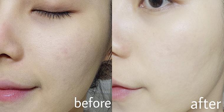 4款自己用过的精华水评测,这三款精华水谁才是油皮亲妈