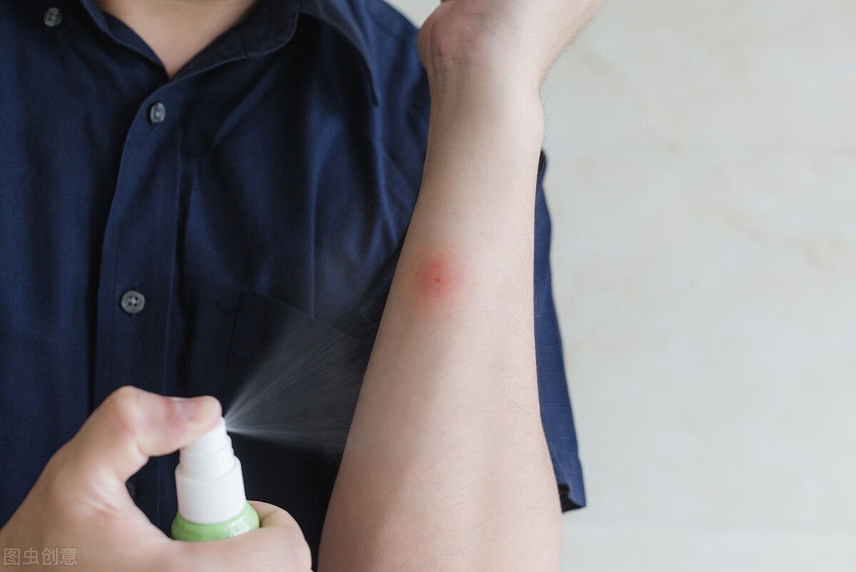 夏天毒虫咬了有土方法吗,户外防止被虫咬的最好方法