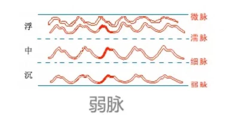 中医28脉诊歌诀及示意图,中医28脉全部脉象图解