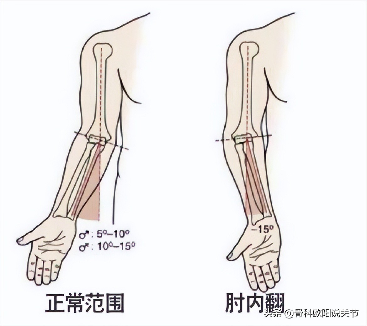 名医讲述滑膜炎,名医专访骨科医生