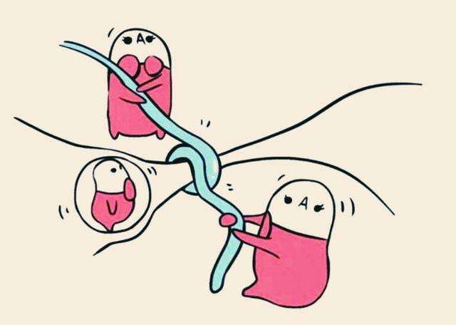 是结扎还是上环?二者差距有点大,哪个对女性的伤害更小