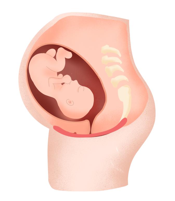 吃好休息好也不能让受损的盆底肌自愈！