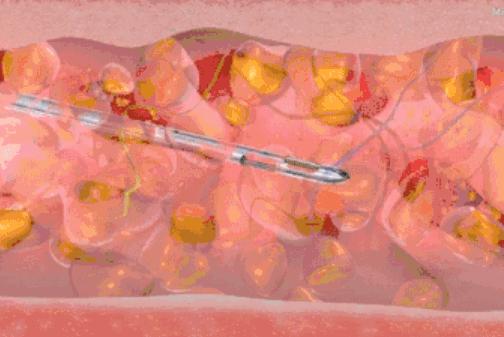 刘雯高级感,刘雯的脸型适合的风格